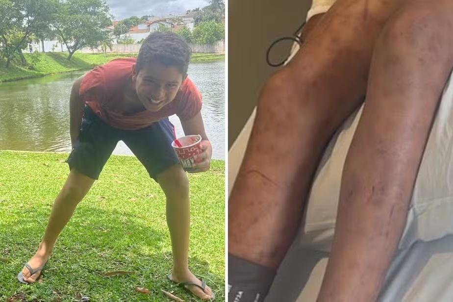 Após 12 dias internado, morre menino picado mais de mil vezes por abelhas em Catalão 